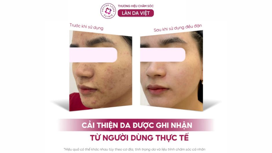 kết quả sữa rửa mặt revskin activecare cleanser