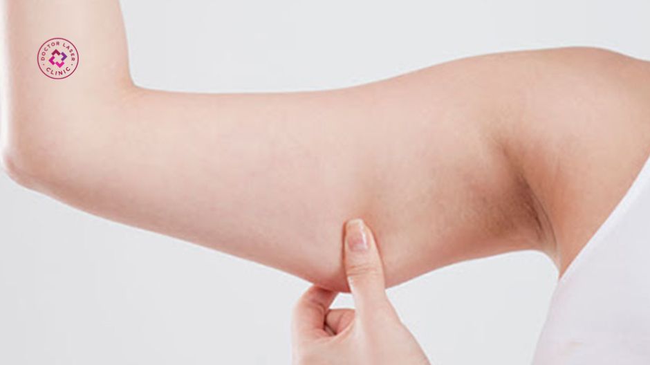không xoa bóp bắp tay sau tiêm botox