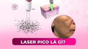 laser pico là gì