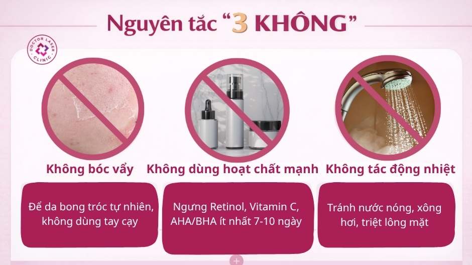 nguyên tắc không nên khi peel