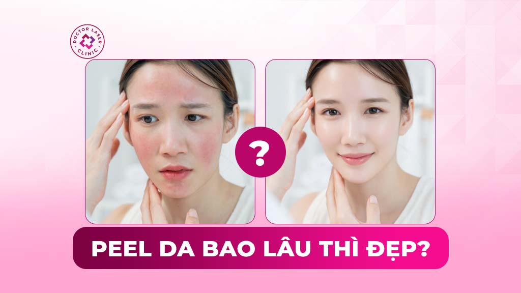 peel da bao lâu thì đẹp
