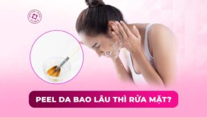 peel da bao lâu thì rửa mặt