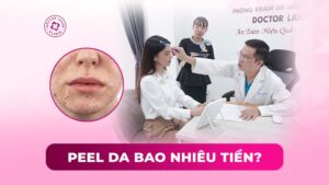 peel da bao nhiều tiền