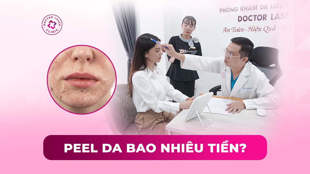peel da bao nhiều tiền