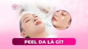 peel da là gì