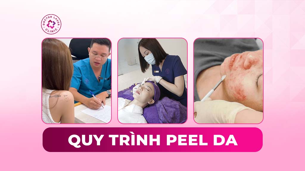 Quy trình peel da chuẩn y khoa theo từng bước cụ thể