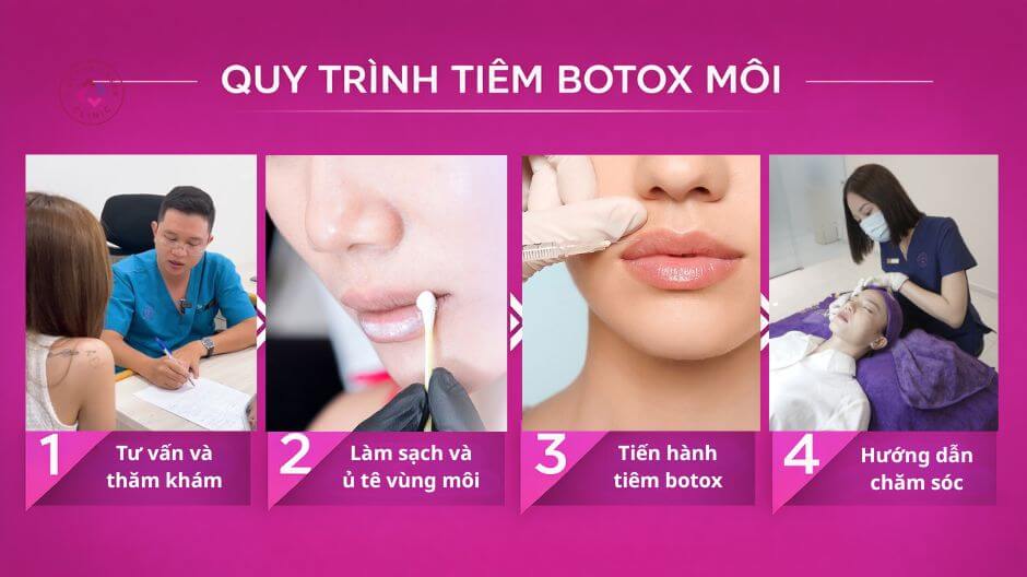 quy trình tiêm botox môi