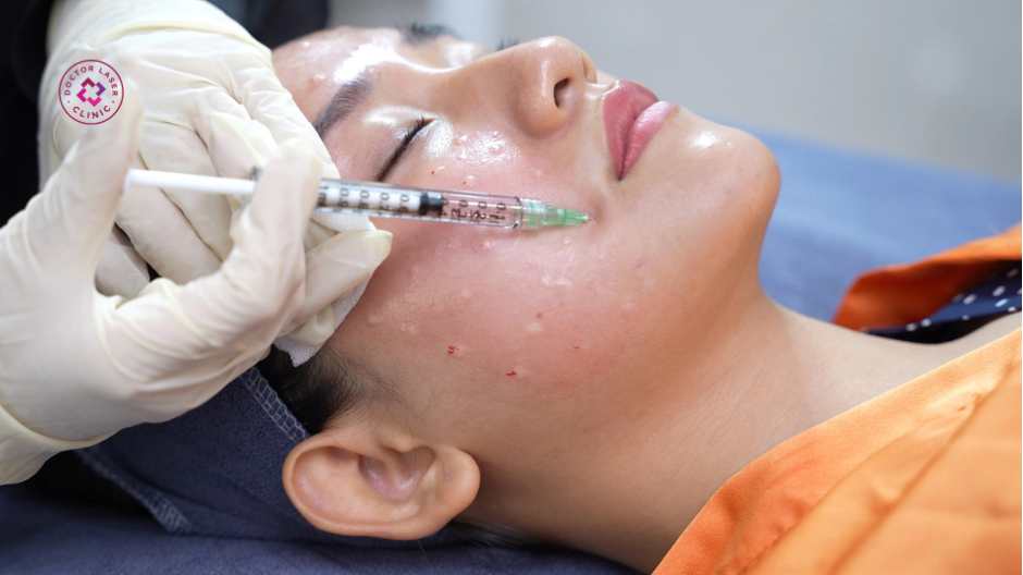 sau tiêm meso bao lâu sinh hoạt bình thường