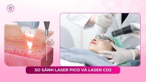 so sánh laser pico và laser co2