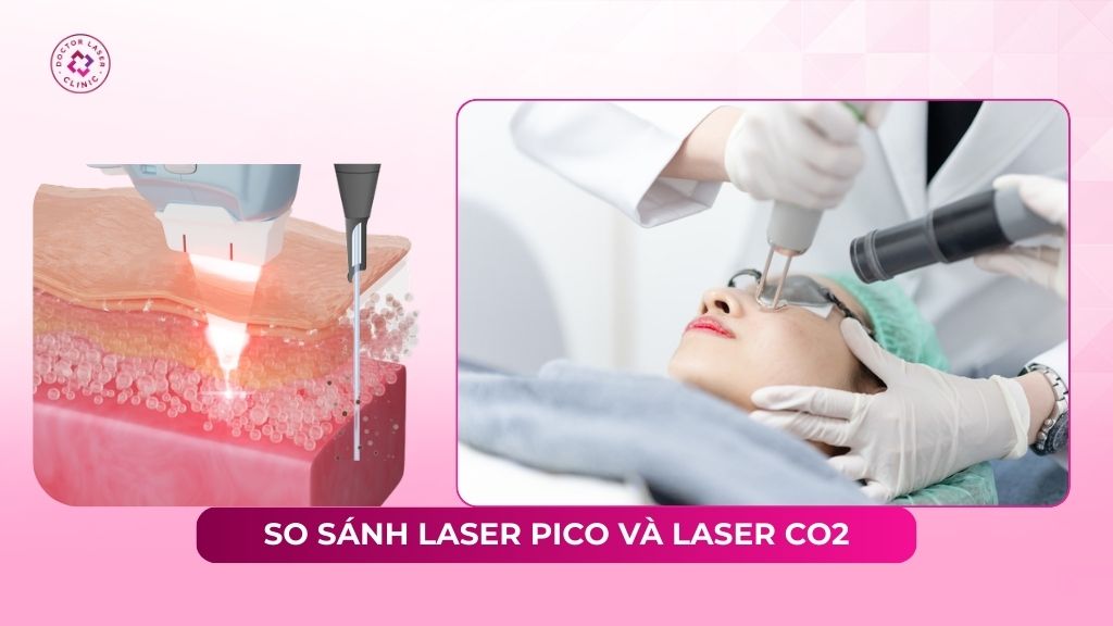 So sánh Laser Pico và Laser CO2 khác nhau thế nào?