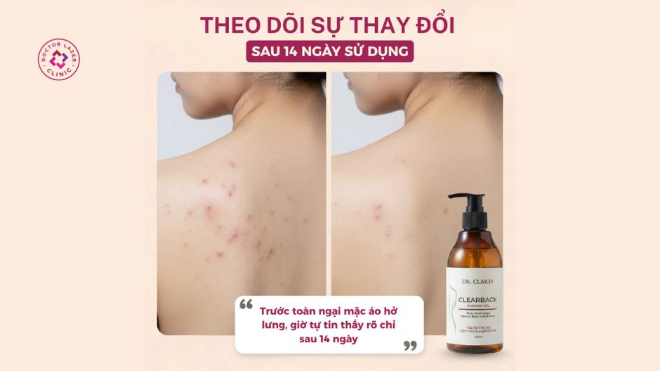 sữa tắm mụn lưng dr clariv hỗ trợ chữa mụn lưng