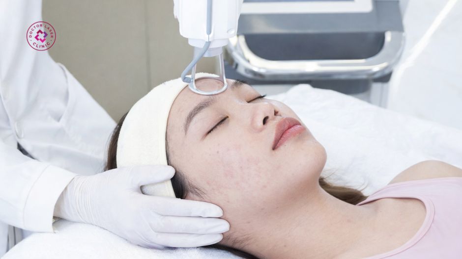 tái tạo bề mặt da bằng công nghệ laser co2 fractional