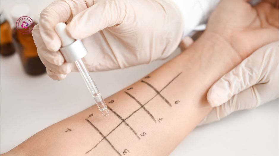 test dị ứng trước tiêm meso