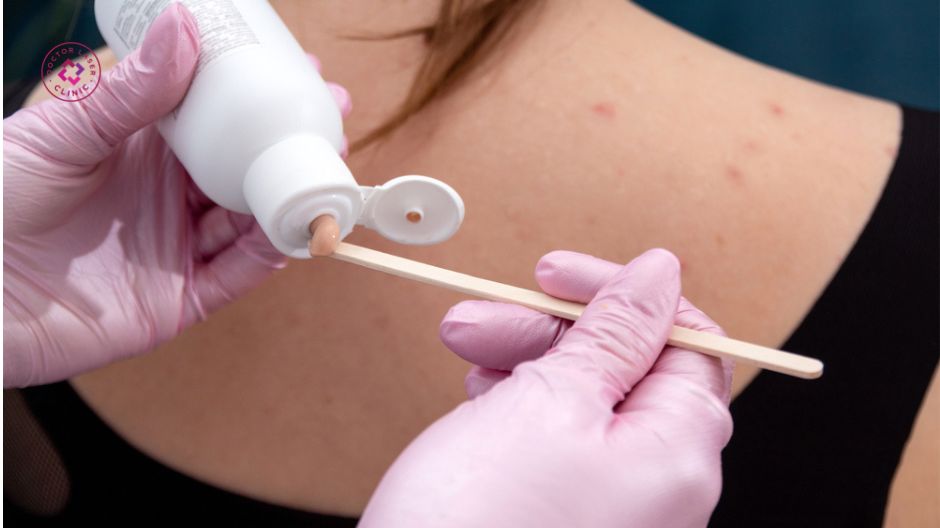 thuốc bôi trị mụn lưng