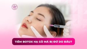 tiêm botox hạ gò má bị đơ do đâu