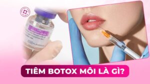 tiêm botox môi là gì