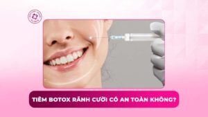 tiêm botox rãnh cười có an toàn không