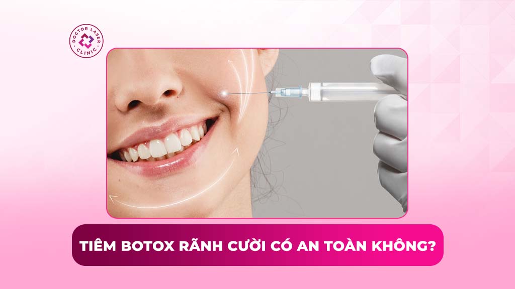 Tiêm botox rãnh cười có an toàn không?