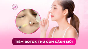 tiêm botox thu gọn cánh mũi tiêm botox thu gọn cánh mũi