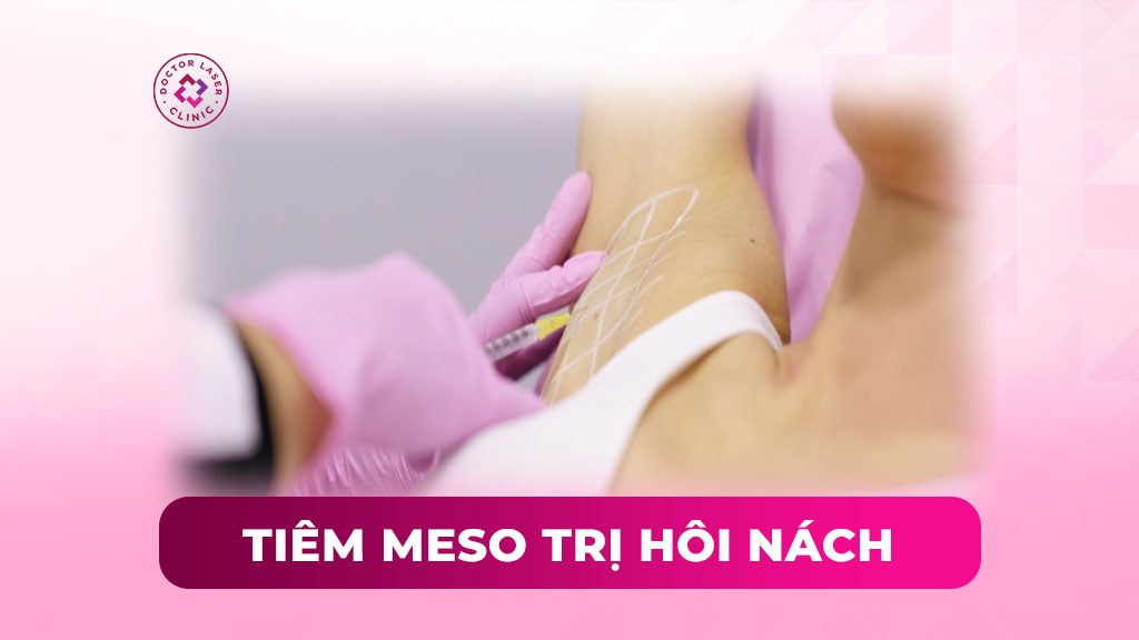 tiêm meso trị hôi nách tiêm meso trị hôi nách