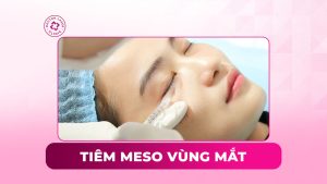 tiêm meso vùng mắt
