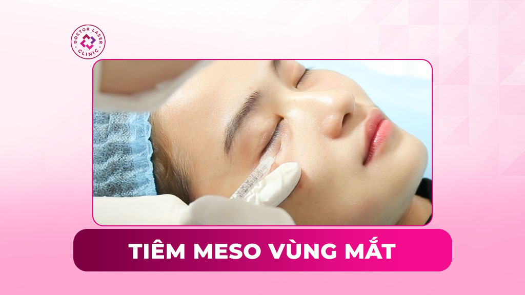 Tiêm meso vùng mắt có tác dụng gì? Phù hợp với ai?
