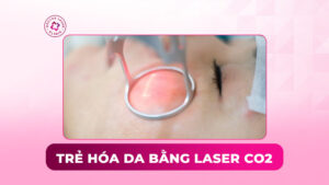 trẻ hóa da bằng laser co2