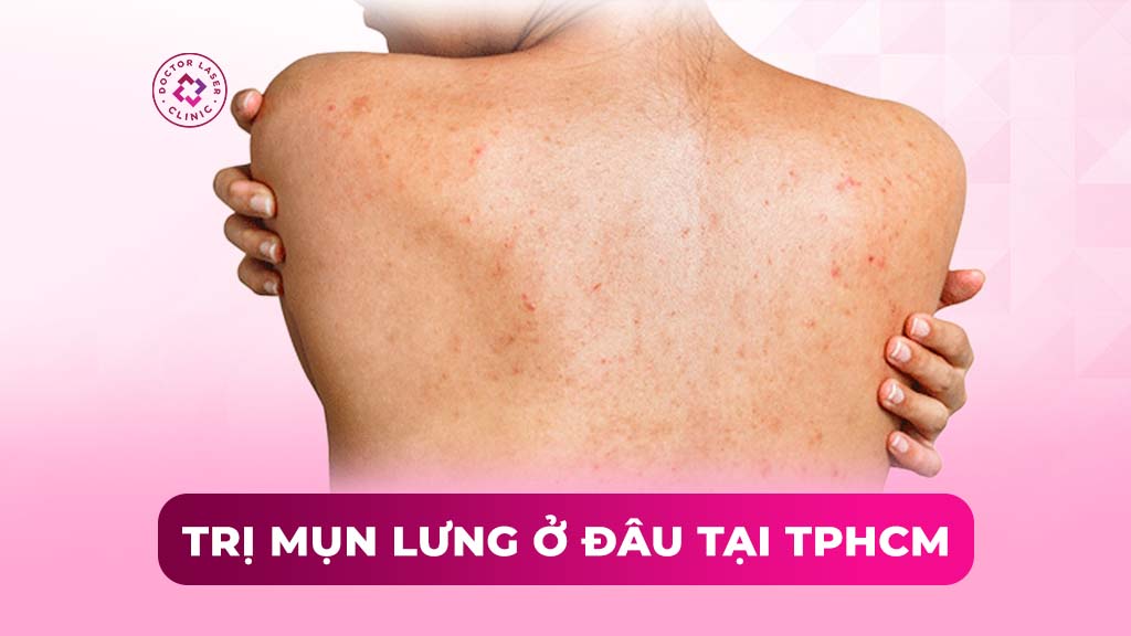 Trị mụn lưng ở đâu tại TPHCM hiệu quả và an toàn?