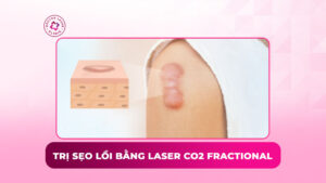 trị sẹo lồi bằng laserco2 fractional