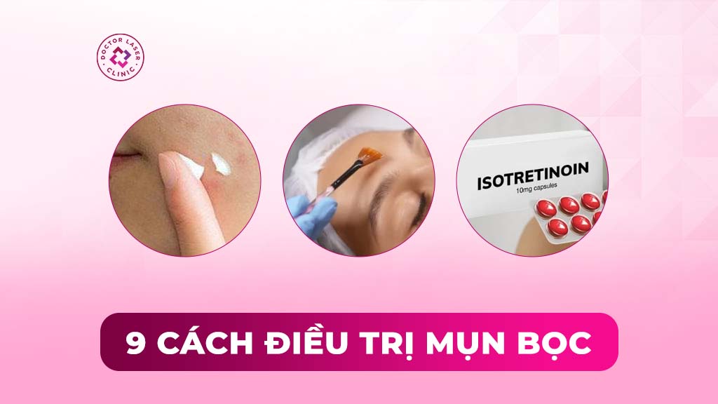 9 cách điều trị mụn bọc hiện nay và hướng dẫn theo từng mức độ