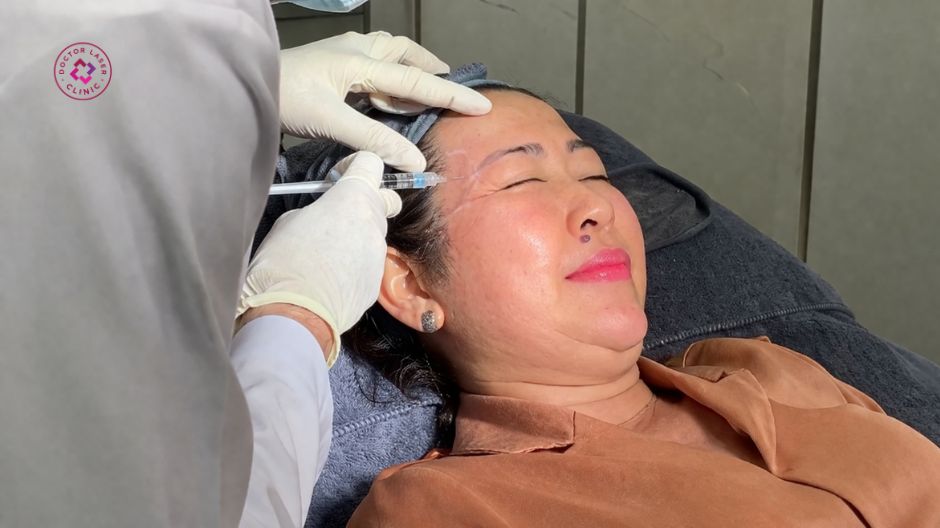 bác sĩ đang thực hiện tiêm filler thái dương 2cc