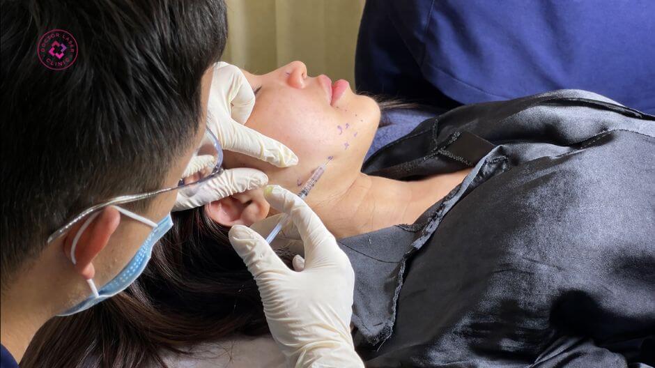 bác sĩ tiêm botox gọn hàm cơ cắn