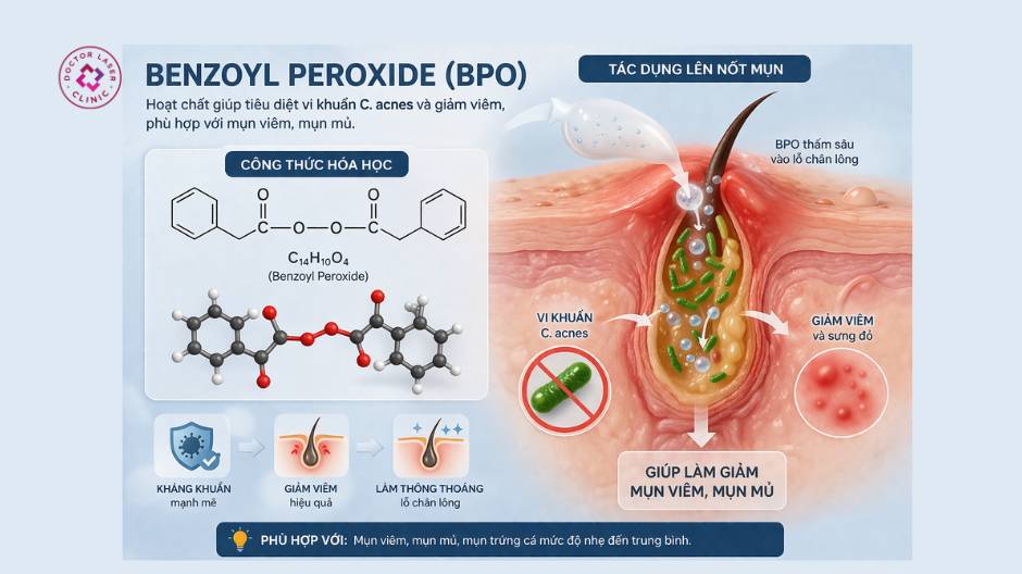 benzoyl peroxide bpo cơ chế trị mụn