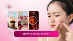 bị mụn bọc kiêng ăn gì