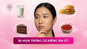 bị mụn trứng cá kiêng ăn gì