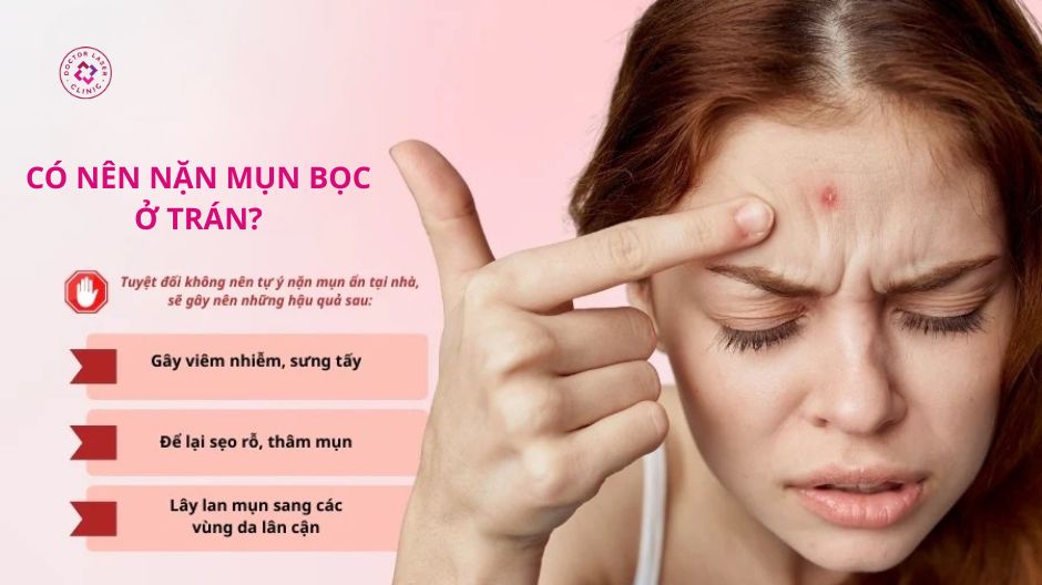 có nên nặn mụn bọc ở trán không