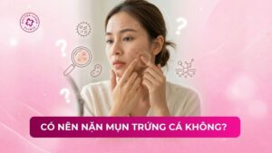 có nên nặn mụn trứng cá không
