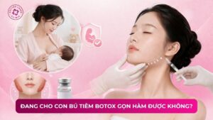 đang cho con bú tiêm botox gọn hàm được không