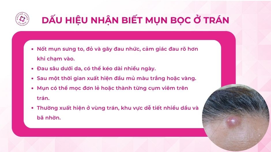 dấu hiệu mụn bọc ở trán sưng đỏ có mủ