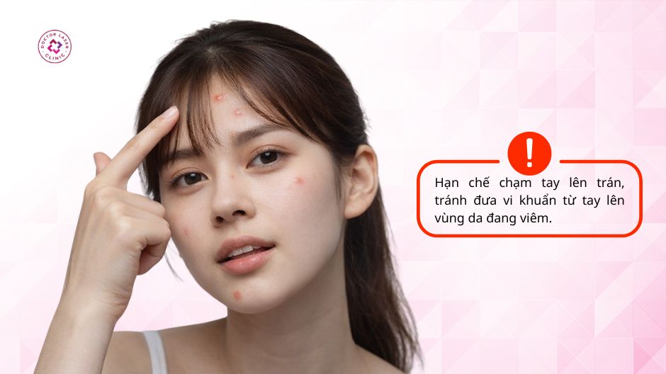 hạn chế chạm tay lên trán khi bị mụn bọc ở trán