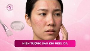 hiện tượng sau khi peel da
