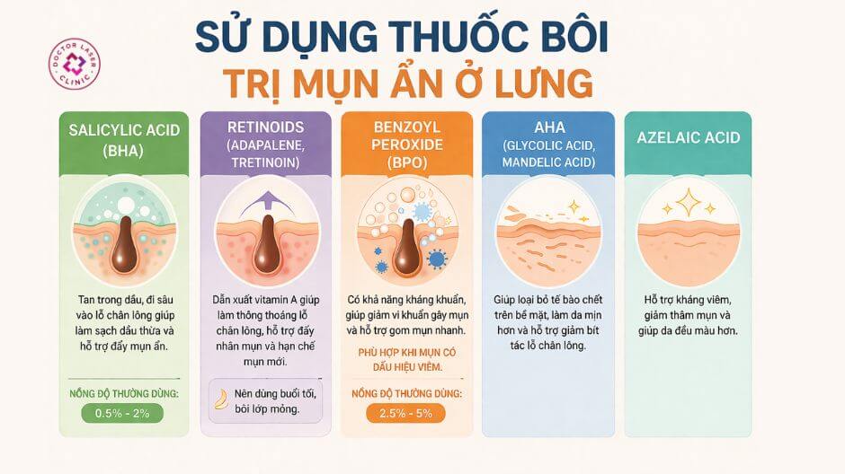 hoạt chất bôi trị mụn ẩn ở lưng