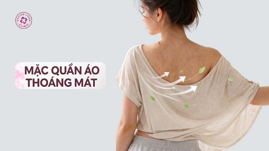 mặc quần áo thoáng mát giảm mụn ẩn ở lưng