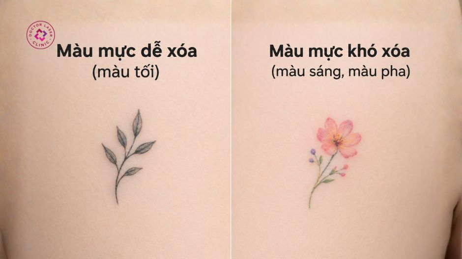 màu sắc mực xăm ảnh hưởng hiệu quả xoá xăm