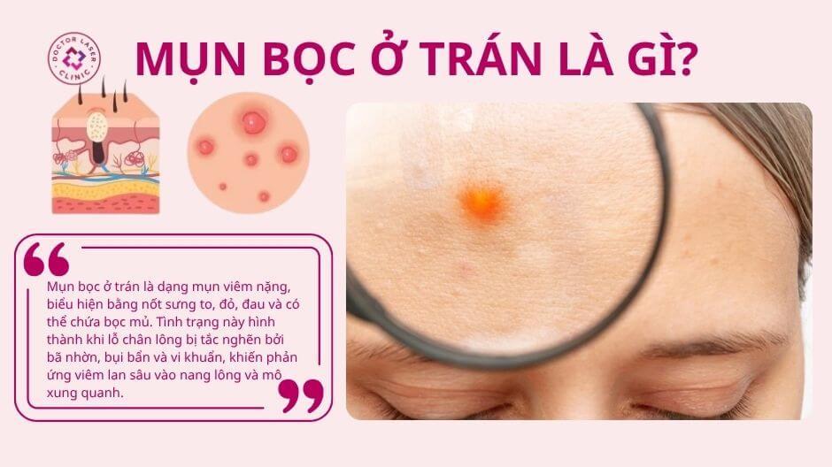 mụn bọc ở trán viêm sưng đỏ