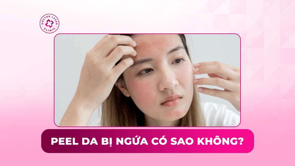 Peel da bị ngứa có sao không? Nguyên nhân và cách xử lý an toàn