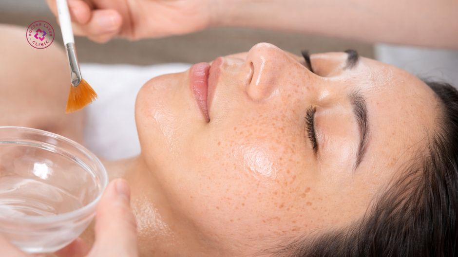 peel da có hết nám không