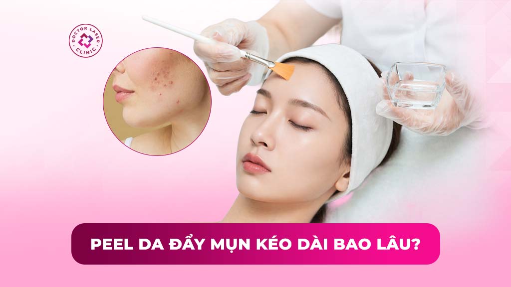 Peel da đẩy mụn kéo dài bao lâu? Nhận diện dấu hiệu rủi ro