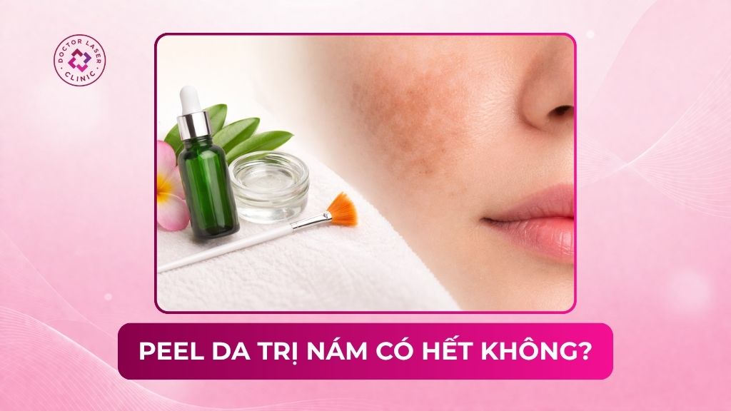 Peel da trị nám có hết không? Yếu tố ảnh hưởng và quy trình