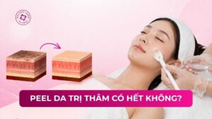 peel da trị thâm có hết không